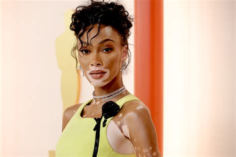 The Wattitude Festival: Celebrating Wisdom and Whimsy with Winnie Harlow